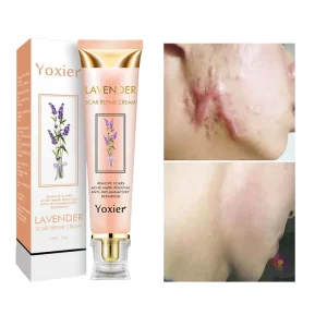 Lavender Herbal Scar Removal Cream Pigment Correction Fast Smooth Skin Comfort Care Factory