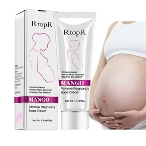MANGO Private Label Stretch Mark Remove Cream Effective Cream for Stretch Mark