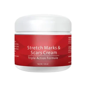 Mango Stretch Mark Cream Private Label Pregnancy Repair Scar Slack Line Abdomen Stretch Marks Cream Custom