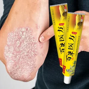 Manufacturers’ customized body care cream is suitable for skin itching eczema ringworm cream psoriasis