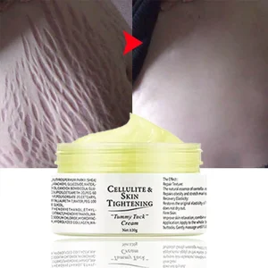 Maternity Skin Repair Cream oem Pregnancy Body Scars Removal private Label Stretch Mark Cream