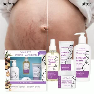 Moisturising Tattoo Aftercare Cream Anti Arrugas Facial Whitening and Reduce Stretch Marks Remover Cream