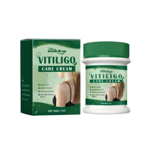 Natural Gentle Vitiligo Care Cream & Ointment with Aloe Vera Mentha Suaveolens Allantoin for Body Moisturizing Skin Health
