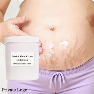 Natural Herbal Body Cellulite and Stretch Mark Cream Tummy Tuck Tightening Stretch Mark Removal Cream