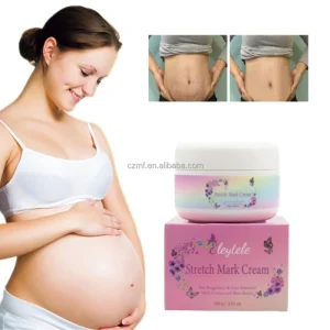 Natural Maternity Private Label Skin Care Anti Stretch Mark Anti Scar Organic Stretch Mark Removal Cream