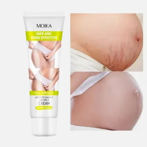 Natural Organic Enhance Skin Elasticity Smooth Reduce Stretch Fat Lines Stretch Mark Repair Cream Scar Removal Cream