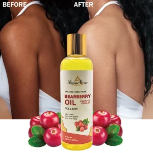 Natural Organic Vitamin C Arbutin Body Oil Skin Whitening and Moisturizing Bearberry Oil for Women