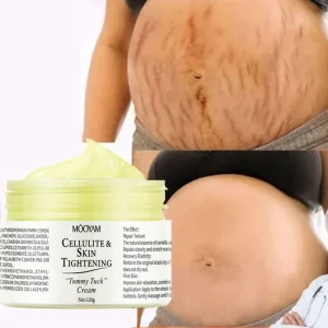 Natural Skincare Repair Body Scars Stretch Marks Cream for Old Scars and Stretch Marks Acne Scar