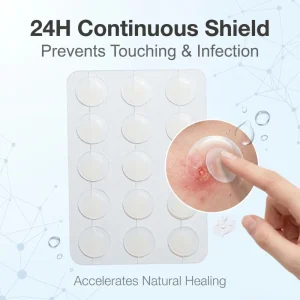 New Arrival Easy to Use Ultra Thin Protection No Trace Left 12mm Invisible Acne Patch for Face