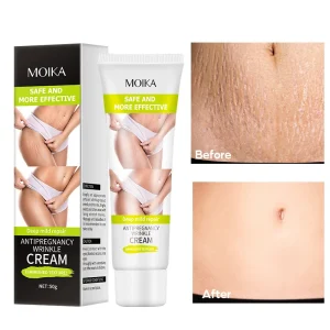 Nourishing Body Cream Postpartum Repair Obesity Tightening Stretch Mark Repair Cream
