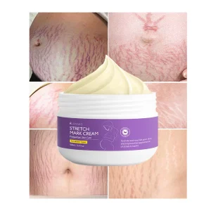 OEM Custom Fat Stretch Mark Repair Cream Firming Nourishing and Diluting Postpartum Pregnancy Mark Tummy Tuck Cream