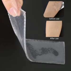 OEM Custom Silicone Scar Gel Removal Dressing Sheet for Body Professional Skin Care Scar Patch with Logo