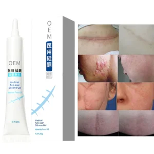 OEM Herbal Skin Repairing Gel Natural Acne Pimple Mark Stretch Marks Scar Removing Cream