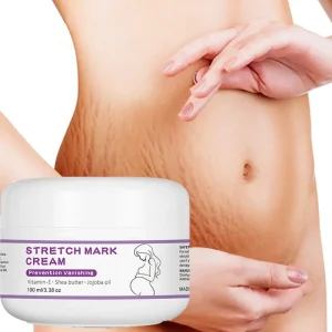 OEM Natural Organic Postpartum Stretch Mark Removal Skin Repair Cream Body Pregnancy Scar Stretch Marks Cream for Women
