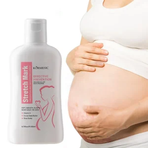 OEM Natural Pregnancy Moisturizing Smooth Remove Stretch Marks Cream Anti Stretch Mark Scar Removal Cream