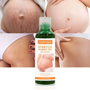 OEM ODM Body Care Anti Treatment Cream Product Scar Repair Abdomen Skin Firming Postpartum Stretch Mark Removal Massage Oil