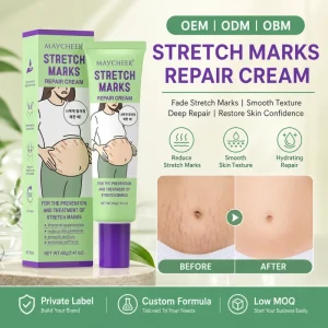 OEM ODM Organic Anti Stretch Mark Remove Cream Firming Removes Scar Postpartum Repair Moisturize Stretch Mark Cream