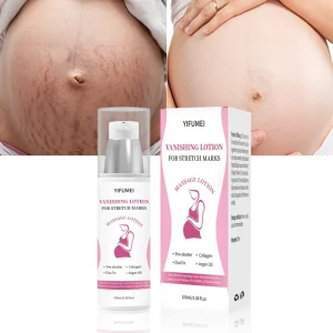 OEM ODM Organic Pregnancy Anti Wrinkle Beauty Whitening Moisturizing Smooth Remove Scar Removal Anti Stretch Mark Cream