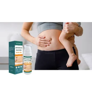 OEM ODM Scar Repair Remove Scars of Surgical and Burn Anti Scar Cream Stretch Mark Removal Gel