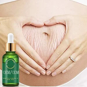OEM ODM Stretch Mark and Scar Removal Oil Stretch Mark Cream