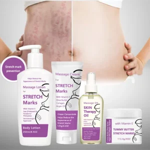 OEM ODM Stretch Marks Cream Skin Repair Anti Vergetures for Thighs Scar Removal Cream Effective and Stretch Mark