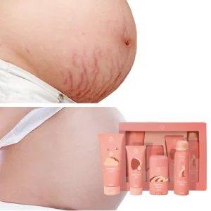 OEM Organic Pregnancy Skincare Set Body Lotion Oil Spray Cream Skincare Kit for Stretch Marks
