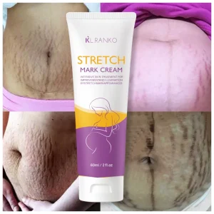 OEM Private Label Stretch Mark Cream Natural Ingredients for Intensive Skin Repair Smooths Scars Softens Damaged Postpartum Care