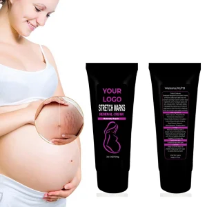 OEM Private Label Stretch Marks Removal Cream Pregnancy Stretch Mark Scar Removal Gel