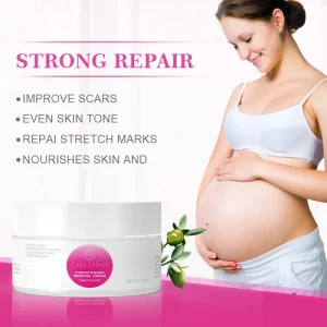 Organic Body Milk Maternal Repair and Whitening Lotion Used to Remove Tight and Slightly Obese Stretch Marks