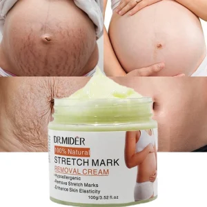 Organic Stretch Mark Removal Cream Anti Wrinkle & Moisturizing Body Lotion Improve Skin Elasticity and Reduce Stretch Marks