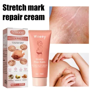 Postpartum Body Care Repair Firming Stretch Marks Cream Vegan Stretch Marks Removal Cream 50ml Volume