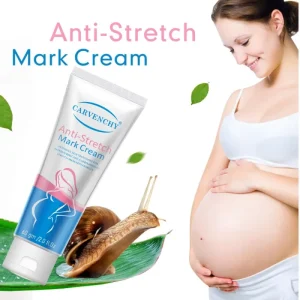 Postpartum Body Repair Cream Anti Stretch Mark and Fine Line Fade Cream