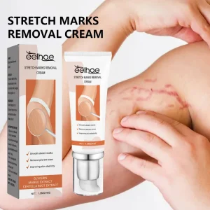 Postpartum Stretch Mark Cream Abdomen Thighs Leg Buttocks Chest Pregnancy Stretch Mark Removal Cream for Female