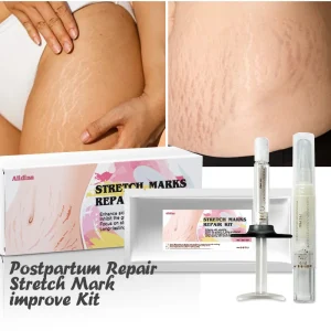 Postpartum Stretch Mark Cream EGF Scars & Stretchmarks Repair Serum Stem Cell Growth Factor Korean Serum Booster Fade Scar Gel