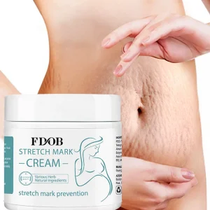 Powerful Stretch Mark Cream Quickly Repair Pregnancy Stretch Marks Postpartum Stretch Marks and Obesity Stretch Marks