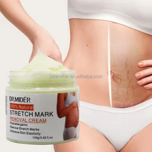 Powerful Stretch Marks Remover Skin Repair Cream Treatment Scar Removal Pregnancy Cream Adults GMP Moisturizer 1pcs