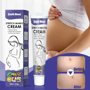 Pregnancy Stretch Marks Repair Cream Before and After Pregnancy Belly Line Repair Skin Firming and Hydrating
