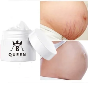 Pregnant Woman Body Stretch Mark Removal Face Cream