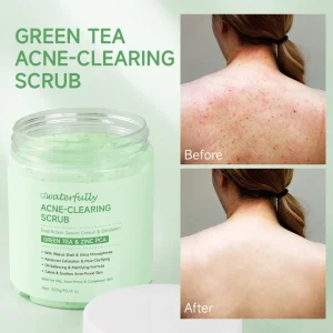 Private Label Acne Clearing Body Scrub Green Tea Zinc PCA Exfoliating Scrub Pore Cleansing Smoothing Scrub 3 NATURAL SCRUB