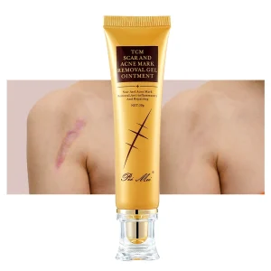 Private Label Acne Scar Face Cream Smooth Acne Scar Stretch Mark Removal Dark Spot Skin Repair Lightening Cream