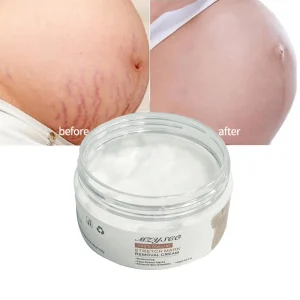 Private Label Body Care Enhance Skin Elasticity Stretch Mark Removal Cream 100g