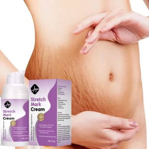 Private Label Body Cream Anti Stretch Mark Product Scar Remove Stretch Mark Cream for Treatment Repair