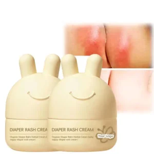 Private Label Body Cream Soothing Moisturizing Relieve Redness Sunburn Aloe Vera Honey Eczema Psoriasis 90mL