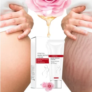 Private Label Gentle Stingless Cream Massage Stretch Mark Repair Cream