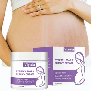 Private Label Maternity Skin Care Anti Stretch Mark Organic Skin Repair Stretch Mark Removal Cream