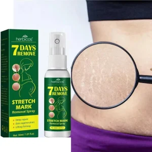 Private Label Maternity Skincare Products Postpartum Spray Stretch Mark Repair Firming Anti-Vergeture Removal Treatment Scar OEM