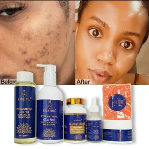 Private Label OEM Logo Skin Whitening Set Glutathione Collagen Brightening Whitening Skin Care Set for Black Women