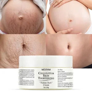 Private Label Organic Deep Scar Removing Repair Anti Pimples Acne Stretch Marks Scar Removal Cream Tummy Tuck Cream