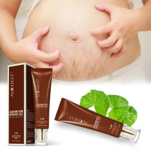 Private Label Organic Herbal Deep TCM Scar and Acne Scar Removal Stretch Mark Repair Cream Gel Ointment