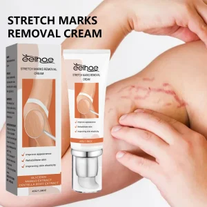 Private Label Organic Lotion Stretch Marks Remover Anti Wrinkle Skin Repair Pregnancy Scar Removal Body Moisturizer